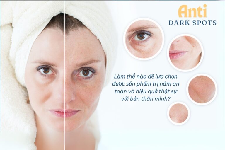 Melasma product development